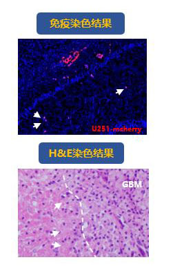 原位肿瘤和转移性肿瘤模型